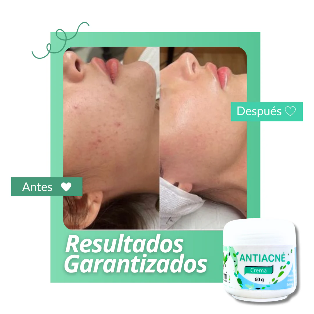 DUO aclarante + antiacne